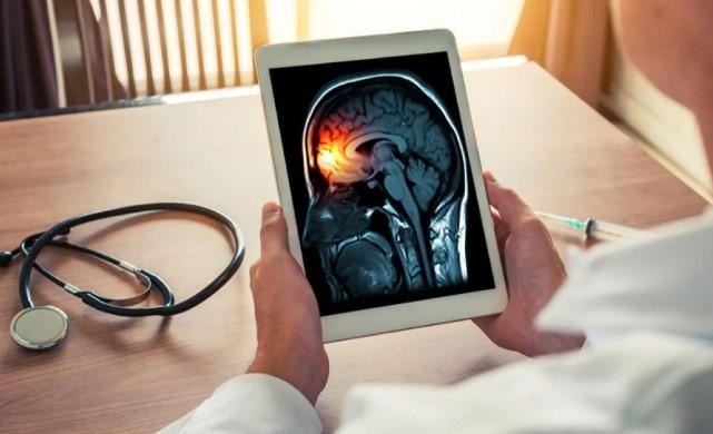 Wabah Meningitis di Inggris Menyebar, Kaum Muda Jadi Kelompok Paling Rentan Terinfeksi