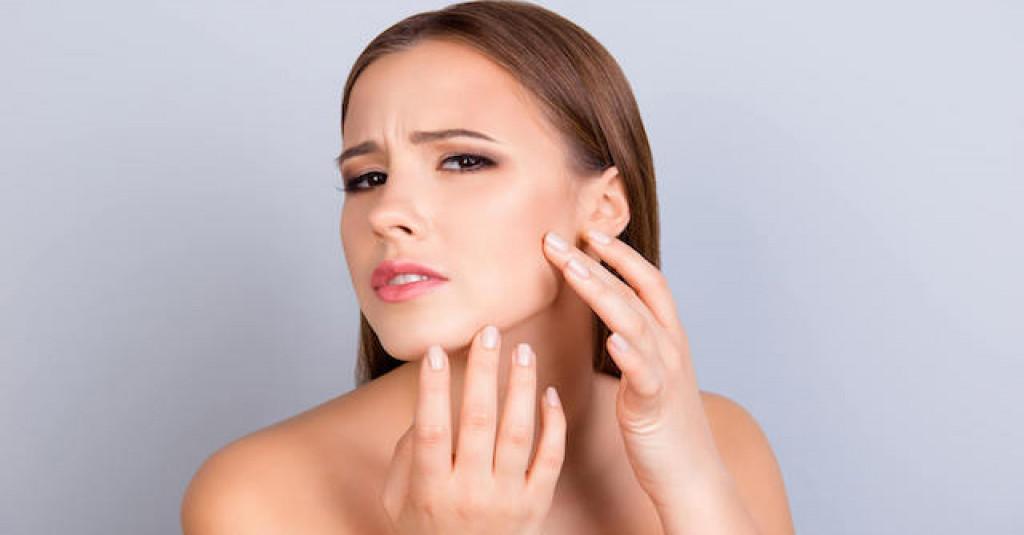 Microneedle Cara Efektif Hilangkan Bekas Jerawat