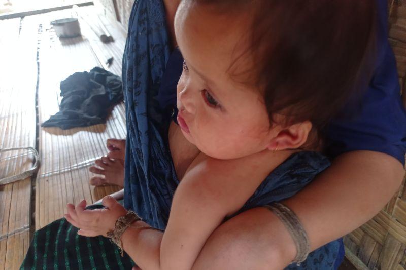 Sembilan Warga Badui Meninggal akibat Suspek Campak dan Tuberkulosis