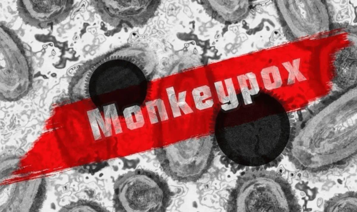 Hati-hati! Virus Mpox Juga Bisa Menular Lewat Kontak Seksual