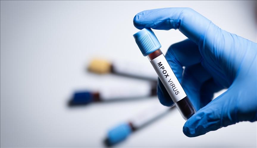 India Catat Kasus Varian Cacar Monyet yang Menyebar Cepat