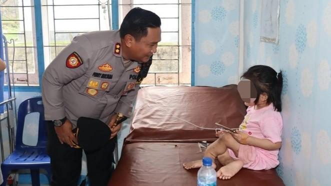 Alasan Tante Aniaya Bocah di Nias Selatan hingga Cacat gegara Kesal Sering Pinjam HP