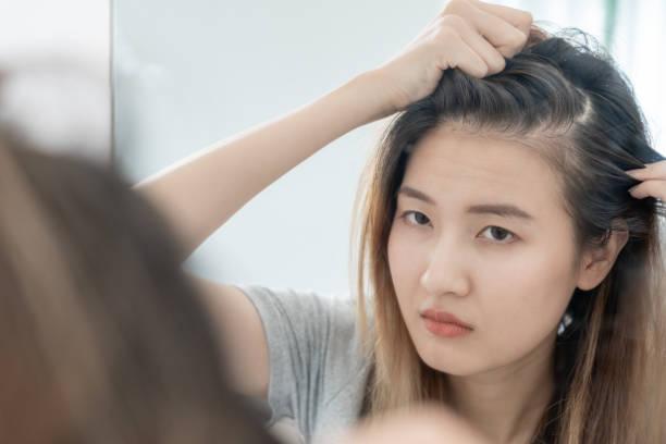 Wajib Tahu! Ini Faktor Penyebab Rambut Beruban di Usia Muda