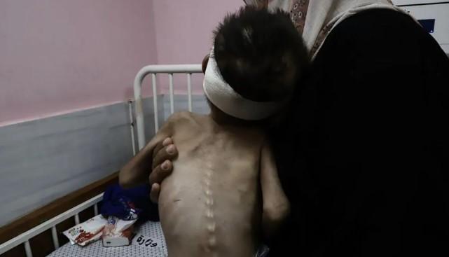 WHO: 57 Anak Gaza Meninggal Kelaparan Sejak Blokade Israel