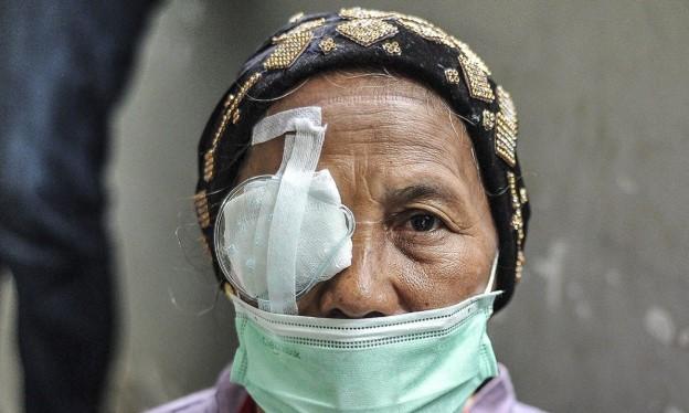 Operasi Katarak Gratis Peringati Hari Lanjut Usia Nasional, Fokus Pulihkan Penglihatan Lansia