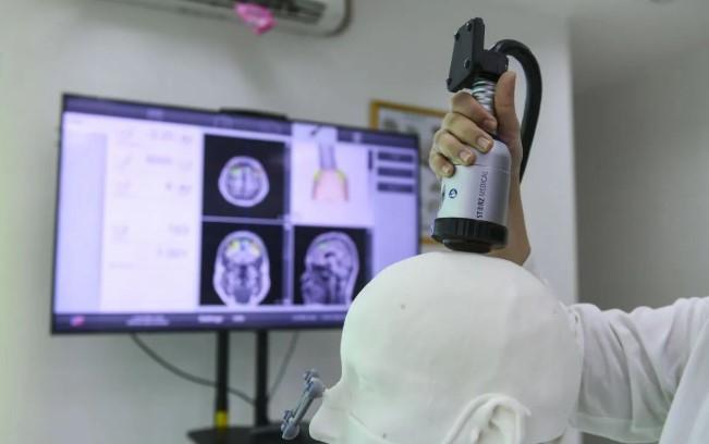 Peneliti Australia Temukan Kaitan Sistem Pembersih Otak dengan Alzheimer, Buka Jalan bagi Terapi Dini