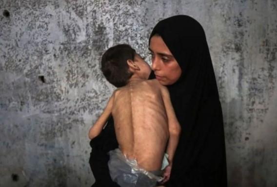 Korban Tewas Akibat Kelaparan di Gaza Capai 212 Orang, PBB: Kondisi Menyayat Hati