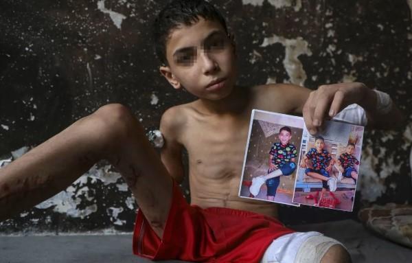 Korban Perang Genosida Israel di Gaza Tembus 61 Ribu Jiwa, Mayoritas Perempuan dan Anak-anak