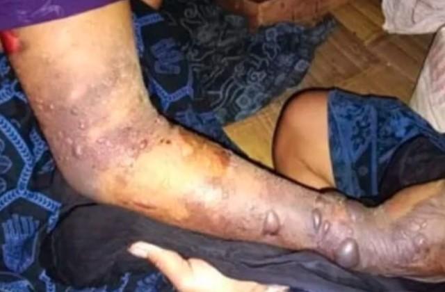 Tujuh Warga Badui Meninggal Akibat Gigitan Ular Tanah, SRI Soroti Krisis Serum Anti Bisa