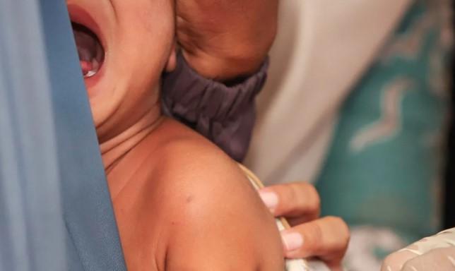 Campak Lebih Menular dari COVID-19, Dokter dan Menkes Imbau Percepatan Vaksinasi Anak