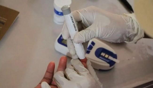 Konsumsi Garam Berlebih Picu Hipertensi di Usia Produktif, Dokter Gizi Serukan Edukasi di Tempat Kerja