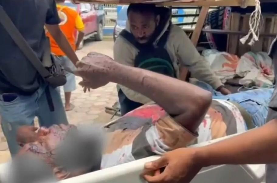 Penumpang Tewas Ditembak KKB di Nabire, Empat Orang Lain Luka dan Mobil Ditembaki Habis-habisan