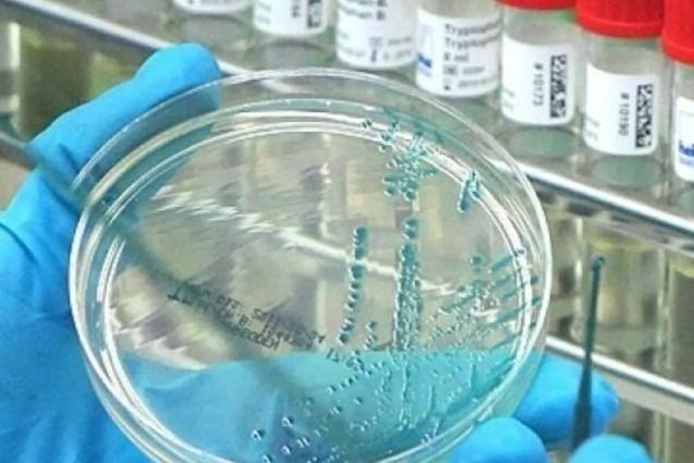 Ilmuwan Rusia Kembangkan Vaksin Baru untuk Flu Burung H5N1 yang Lebih Efektif dan Aman