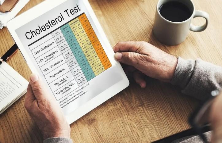 Tiga Faktor Tersembunyi Ini Diam-Diam Picu Kenaikan Kolesterol Tanpa Disadari