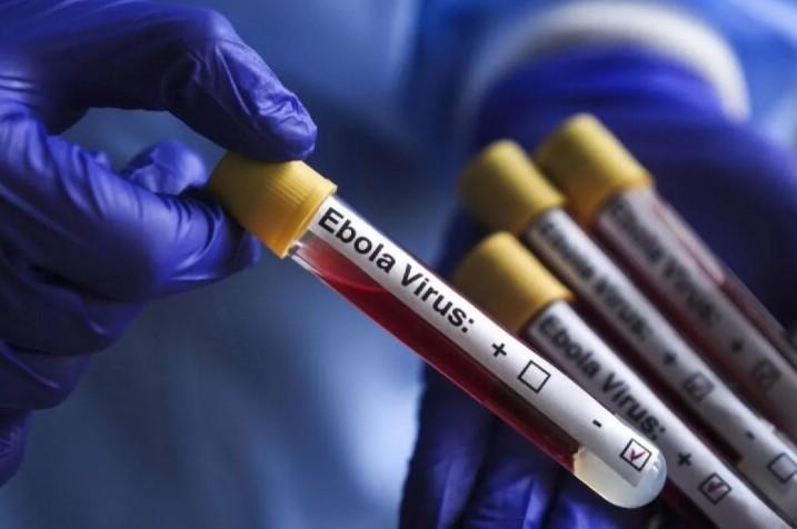 AS Pasang Alat Uji Ebola di Bandara Utama Jelang Piala Dunia 2026
