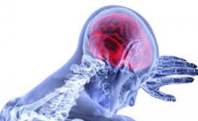 Peneliti Australia dan China Kembangkan Arteri di Atas Cip untuk Prediksi Risiko Stroke Lebih Akurat