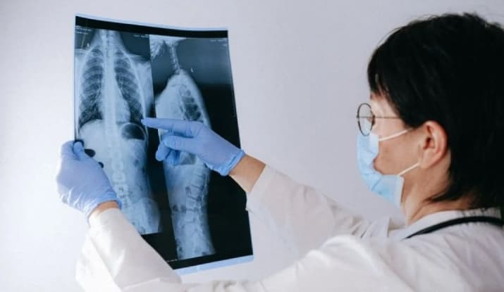 Layanan Navigasi Pasien Didorong Percepat Diagnosis dan Pengobatan Kanker Paru di Indonesia