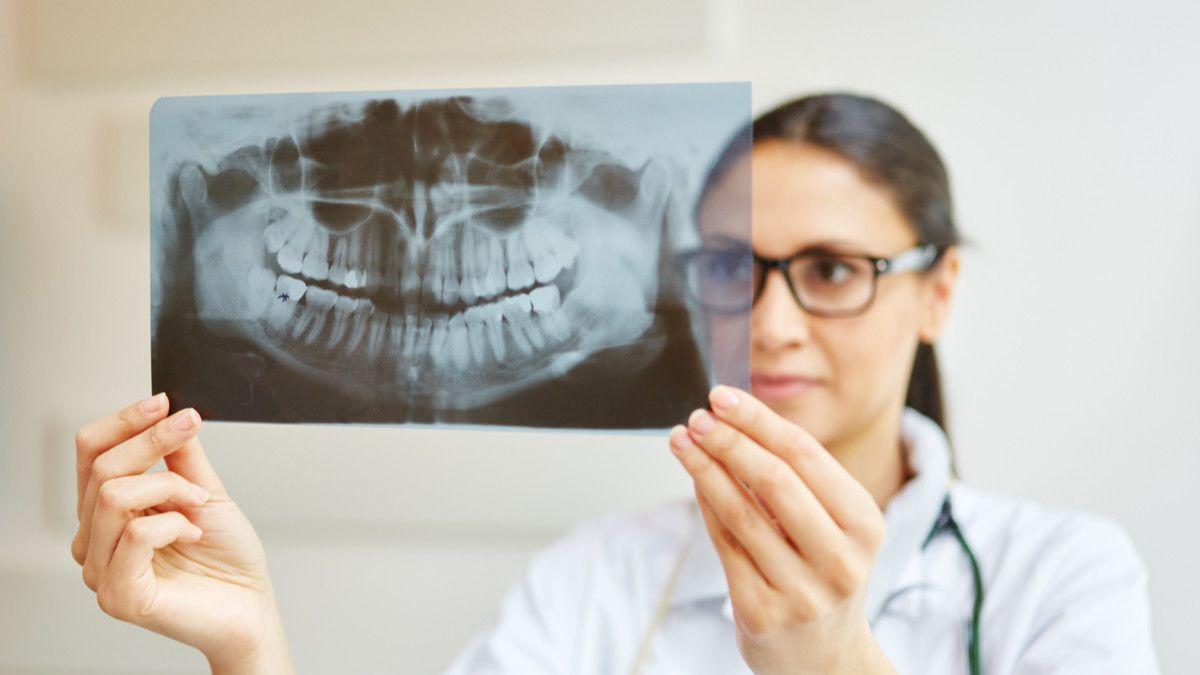 Waduh, Dokter Bedah Ini Menjual Rontgen Pasiennya di NFT